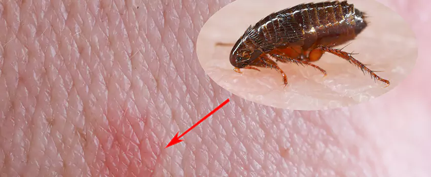 Flea Control for Humans Lake Elsinore, CA